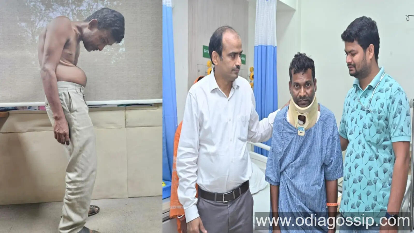 KIMS Doctors Restore Straight Posture of Man Whose Neck Had Been Bent Since Childhood