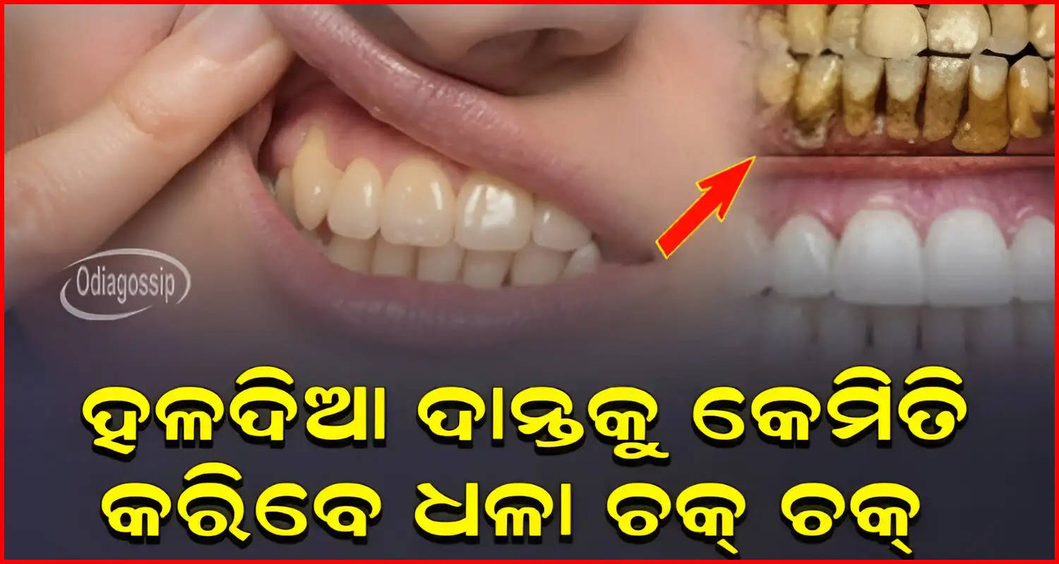 How to get rid of yellow teeth know home Remedies