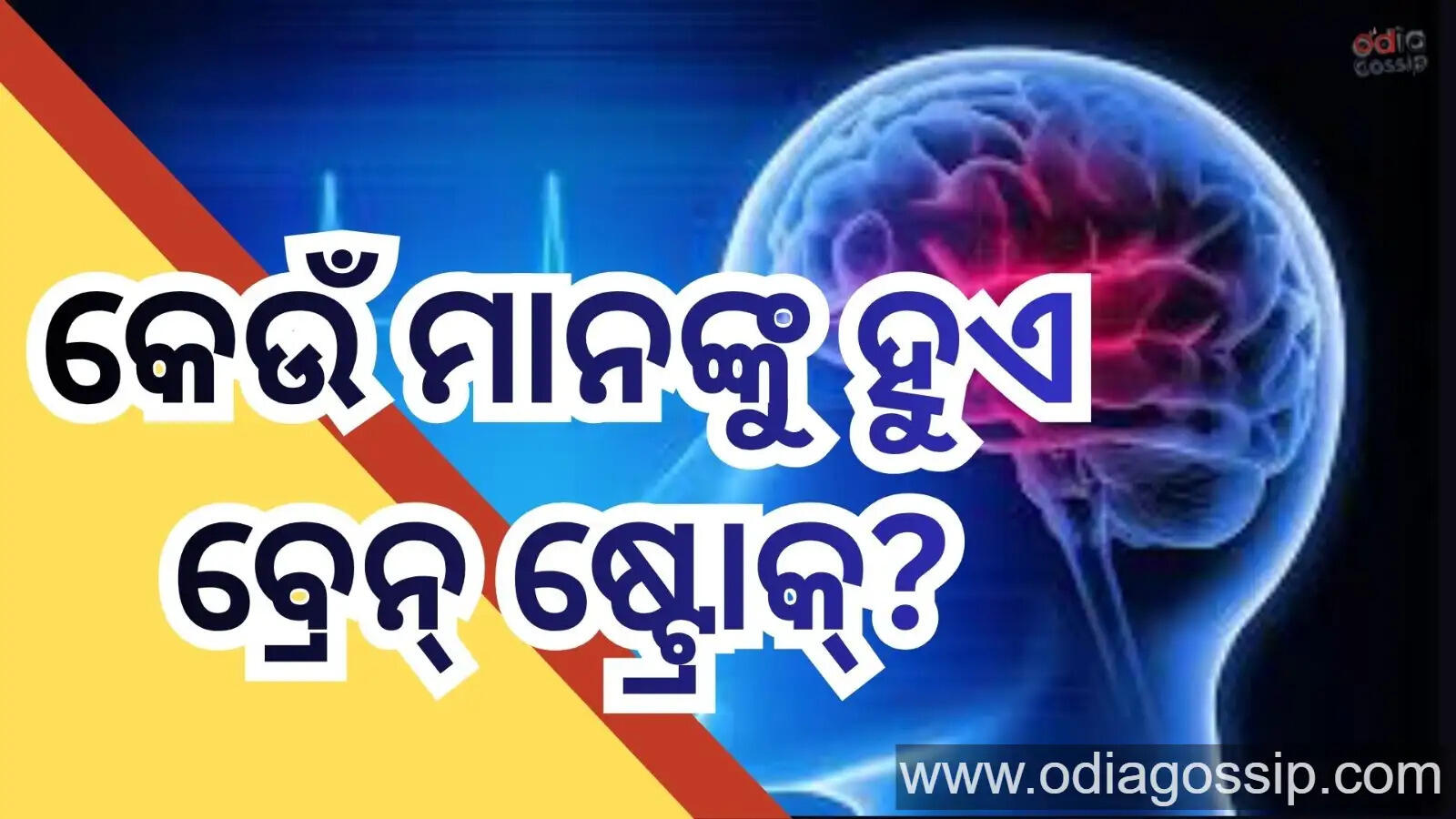 Why Does A Brain Stroke Occur Know The Details About Symptoms 