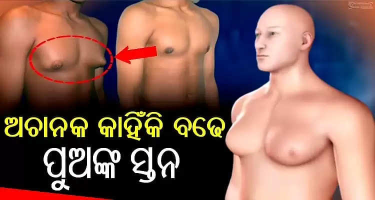 health tips why do male children chest nipple size enlarges