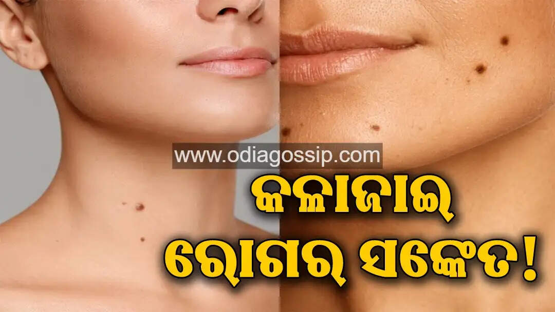 Be careful are you seeing black marks on your neck Find out what disease it is a sign of