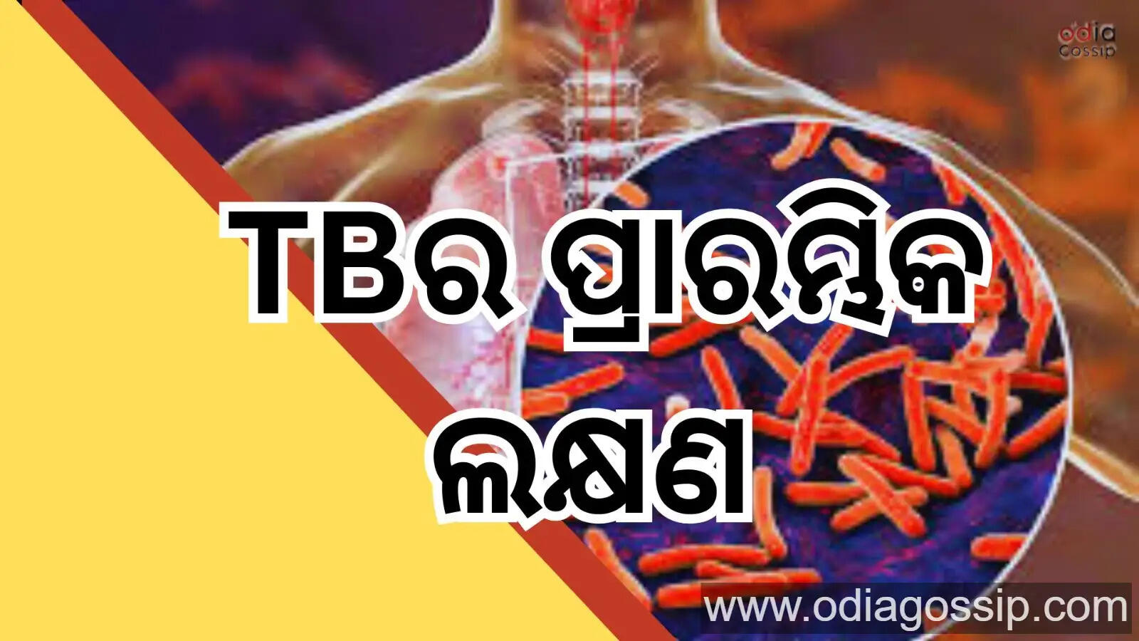 TB Disease Health Problem 7Most Common And Dangerous Early Sign Know The Symptoms