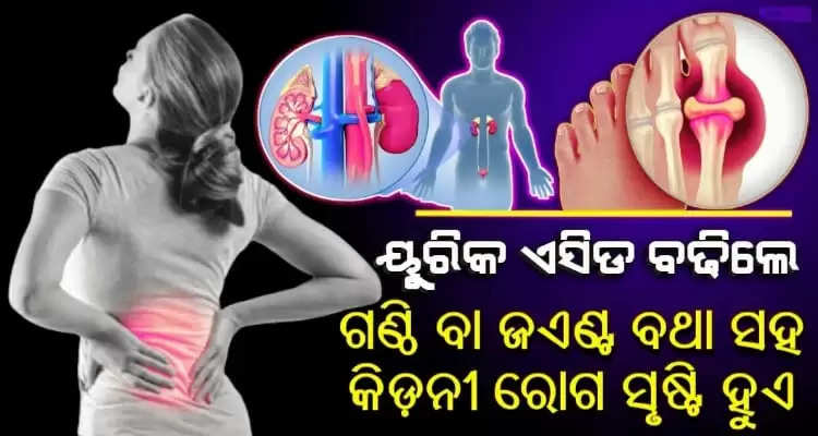Effective Home Remedies to Reduce Uric Acid Naturally and keep the kidneys healthy